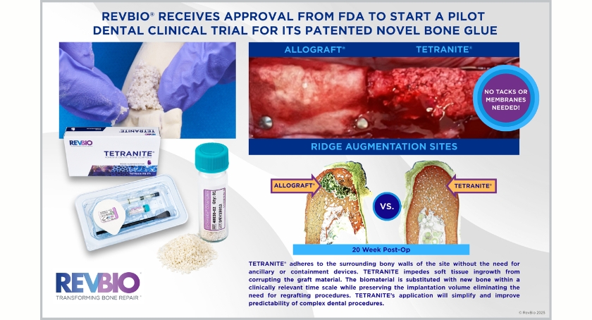 RevBio Wins FDA Nod for Dental Trial of Regenerative Bone Glue